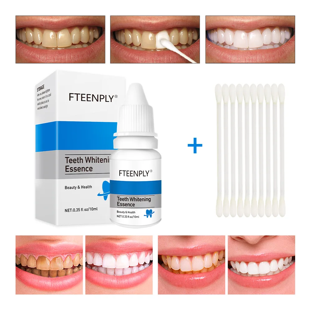 FTEENPLY Teeth Whitening Essen - Teeth Whitening Results recension och pris