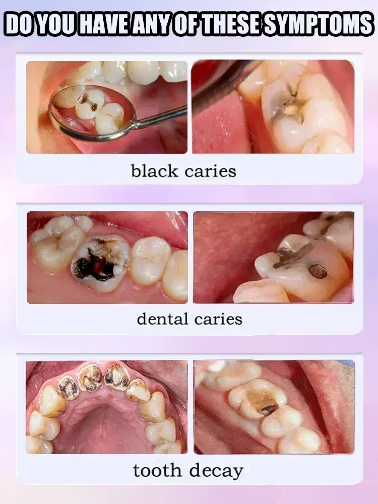 Tooth decay Repair Repairing C - Teeth Whitening Charcoal Powder recension och pris