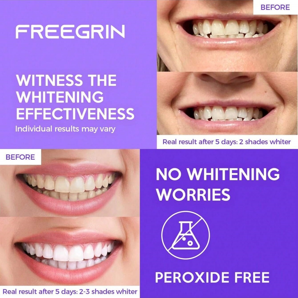 Deluxe Whitening Teeth Sticker - Teeth Whitening Results recension och pris
