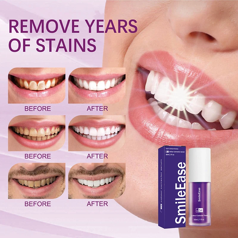 45ml Smilekit Purple Tooth Mou - Teeth Whitening Mousse recension och pris