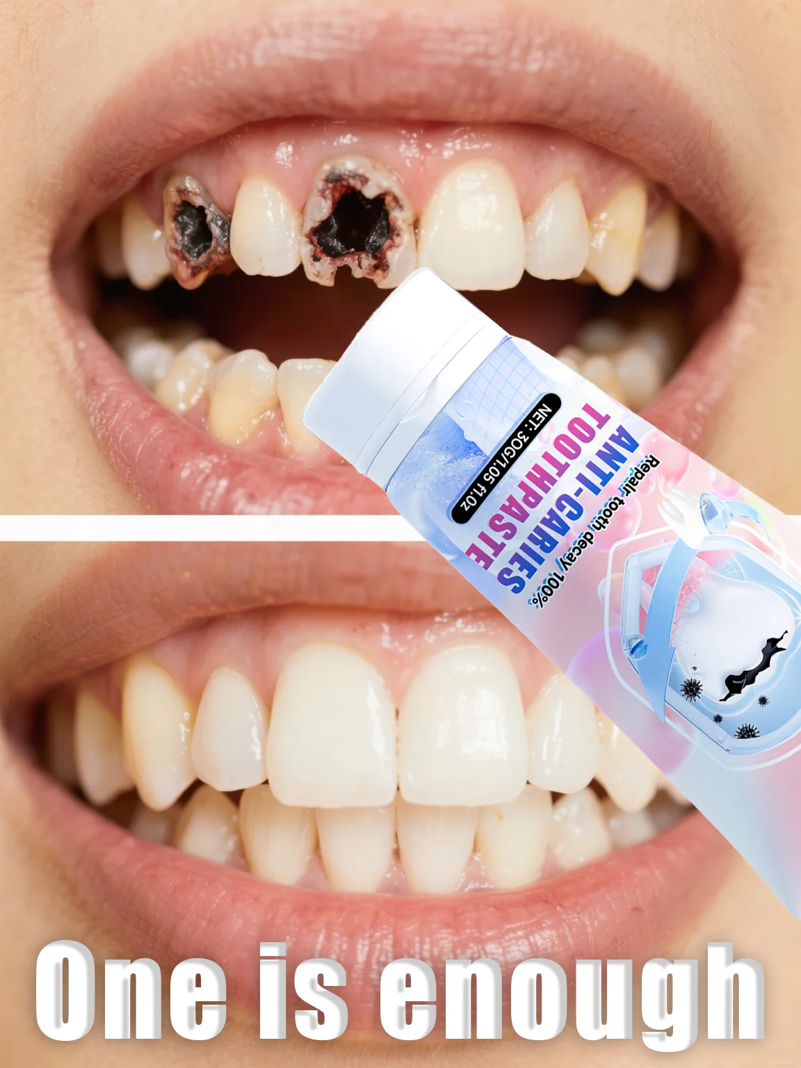 ⁹⁹% ᵒᶠ ᵖᵉᵒᵖˡᵉ ʳᵉᵖᵘʳᶜʰᵃˢᵉ ᵗᵒ ʳᵉ - Teeth Whitening Charcoal Powder recension och pris