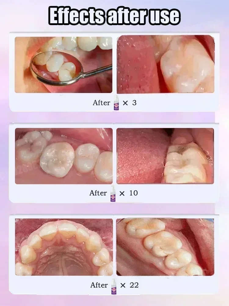 Teeth Cleaning Toothpaste Remo - Teeth Whitening Charcoal Powder recension och pris